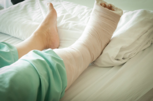 Can You Sleep on Your Side With a Broken Ankle?